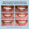 imageAuraglow Teeth Whitening Kit ampamp Extra Strength Whitening Pen