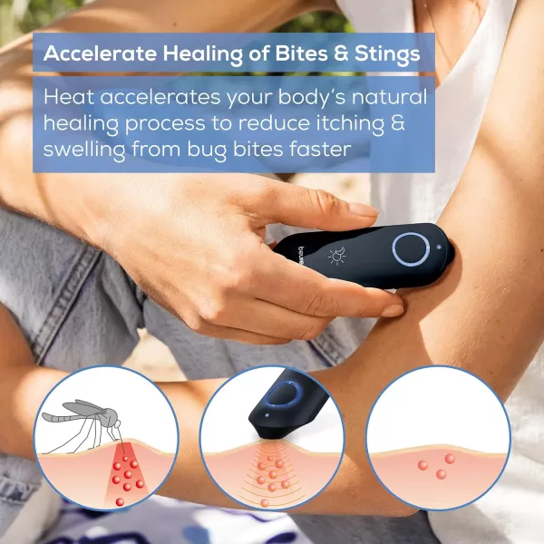 Beurer BR90 Insect Sting and Bite Relief with Light ChemicalFree Bug Bite Healer for Day and Night Electronic Heat Device for After Mosquito Bites to Ease Itching and SwellingBR90  Insect Bite Healer with Light