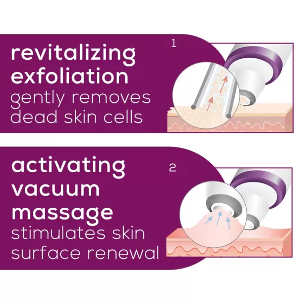 Beurer Blackhead Remover Pore Vacuum with 3 Suction Head Attachments amp 5 Suction Levels for All Skin Types  Blackhead Vacuum for Deep Cleansing FC41Microdermabrasion