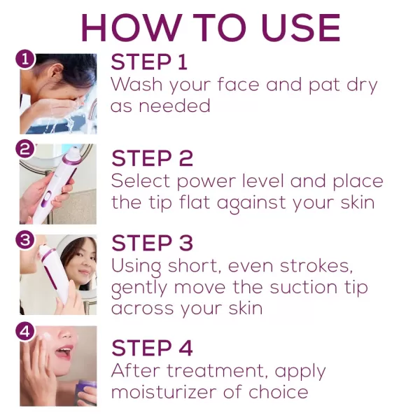 Beurer Blackhead Remover Pore Vacuum with 3 Suction Head Attachments amp 5 Suction Levels for All Skin Types  Blackhead Vacuum for Deep Cleansing FC41Microdermabrasion